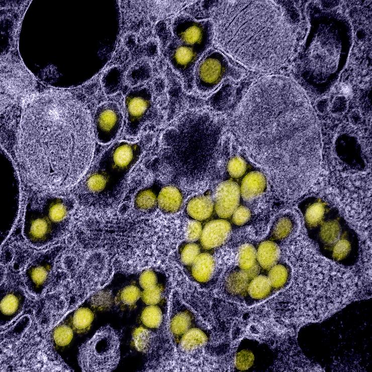 Micrografía electrónica de transmisión de partículas do virus SARS-CoV-2, illada dun paciente e con realce da cor, do Instituto estadounidense de Alerxia e Enfermidades Infecciosas (NIAID), en Hamilton, Estados Unidos 
