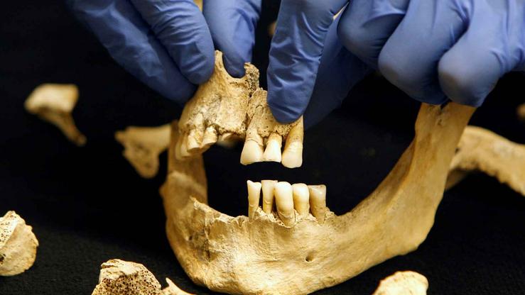Dentes para o seu estudo arqueolóxico / Commons - Arquivo